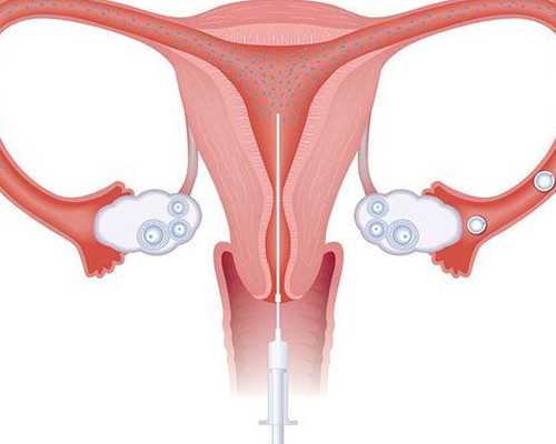 辅助生殖：探寻供卵代怀与试管助孕的希望之路