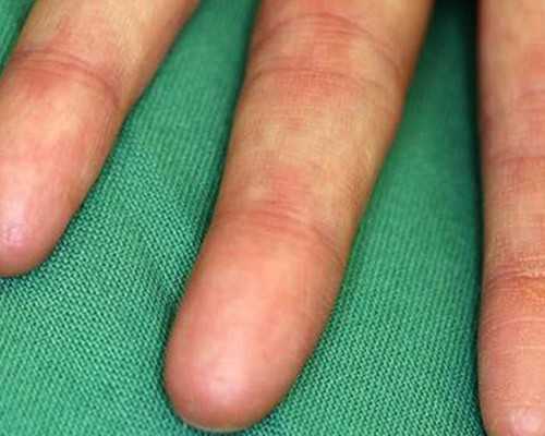 辅助生殖：高效取卵与胚胎培养的关键策略