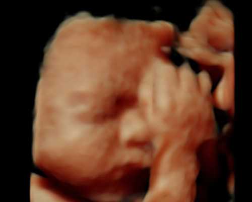 乌克兰辅助生殖攻略：代怀机构选择、代孕供卵成功率与代生包成功费用解析