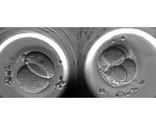 深圳助孕价格,深圳代生男孩,深圳代生妈妈-真爱代孕公司电话-代孕中心靠谱吗