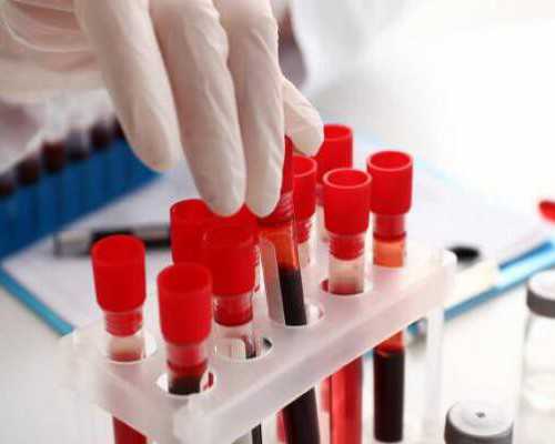 取卵后腹水50mm正不正常，持续时间多久过去因人而异