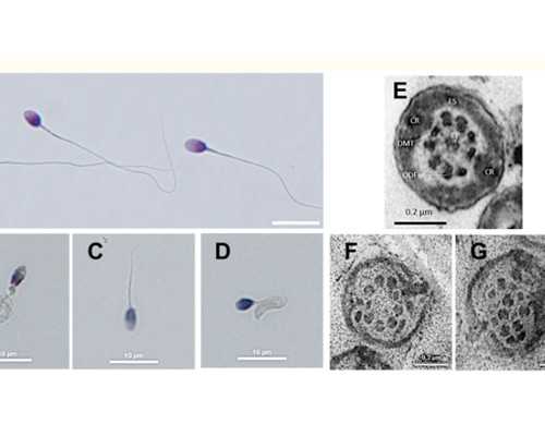 乌克兰供卵靠谱,乌克兰供卵试管医院排名榜_乌克兰供卵试管医院排名